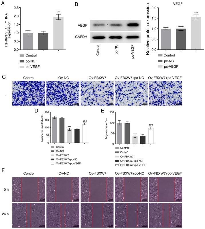 https://cdn.ncbi.nlm.nih.gov/pmc/blobs/e937/8005732/4ce7c3b0bf44/etm-21-05-09945-g01.jpg