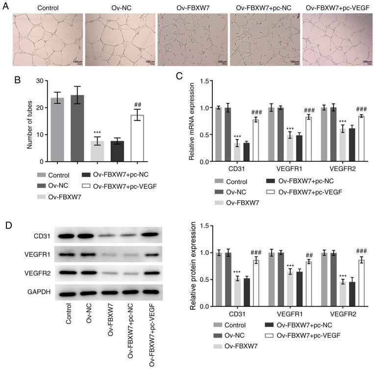 https://cdn.ncbi.nlm.nih.gov/pmc/blobs/e937/8005732/8af6e04e3eb1/etm-21-05-09945-g03.jpg