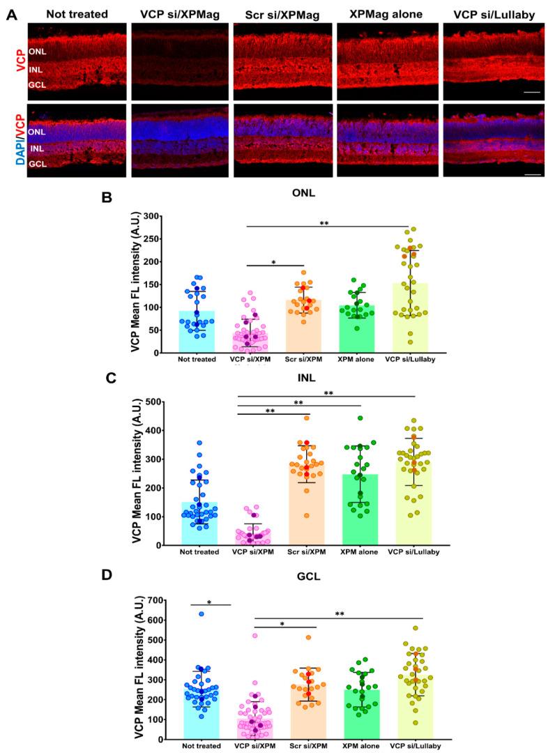 https://cdn.ncbi.nlm.nih.gov/pmc/blobs/e93b/7914601/d59c2a14d1b4/pharmaceutics-13-00225-g004.jpg