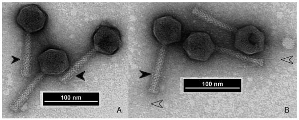 https://cdn.ncbi.nlm.nih.gov/pmc/blobs/e93c/2674420/ad5a2a9ca5e2/1743-422X-6-41-1.jpg