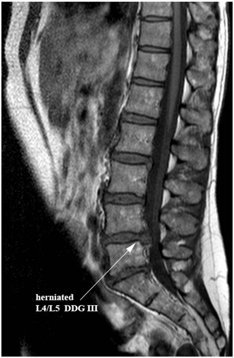 https://cdn.ncbi.nlm.nih.gov/pmc/blobs/e93c/5313142/ee2a98388178/pone.0172181.g001.jpg