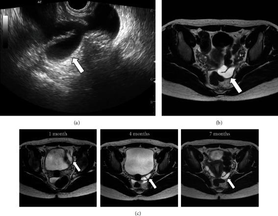 https://cdn.ncbi.nlm.nih.gov/pmc/blobs/e944/10824574/d9966c9e28ce/CRIS2024-2581337.001.jpg
