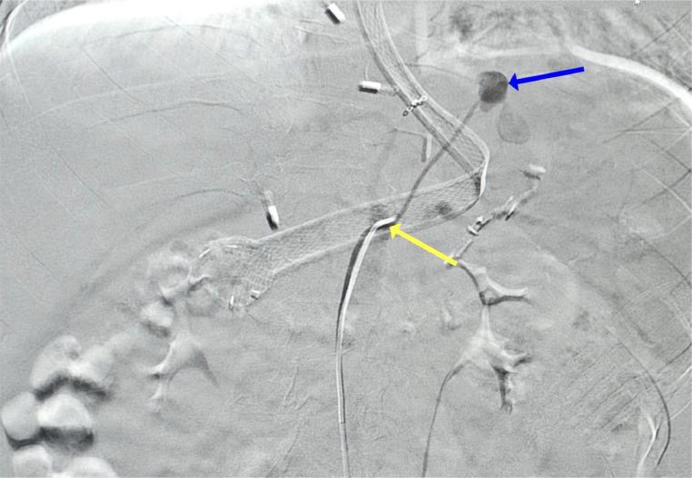 https://cdn.ncbi.nlm.nih.gov/pmc/blobs/e946/10963892/47e7695e5923/gr2.jpg