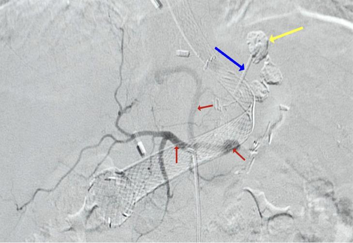 https://cdn.ncbi.nlm.nih.gov/pmc/blobs/e946/10963892/7aa780b4f31b/gr4.jpg