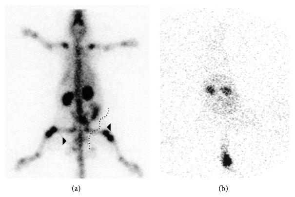 https://cdn.ncbi.nlm.nih.gov/pmc/blobs/e946/4337049/d2b6995be855/TSWJ2015-676719.002.jpg