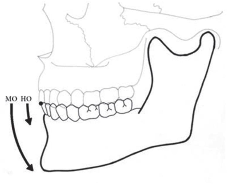 https://cdn.ncbi.nlm.nih.gov/pmc/blobs/e957/4279047/e6c70776f7c6/jap-6-483-g004.jpg