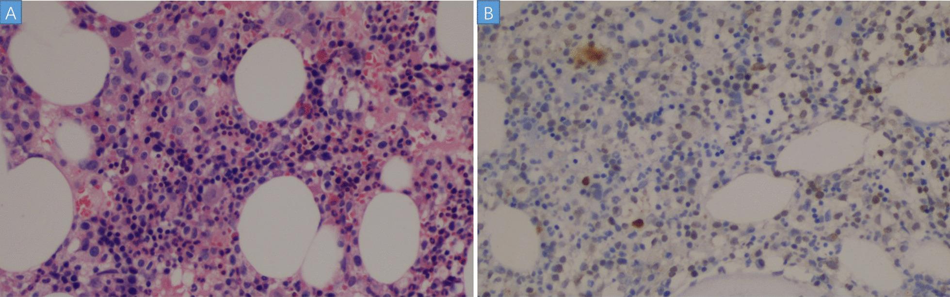 https://cdn.ncbi.nlm.nih.gov/pmc/blobs/e957/8642915/4cbb31980675/12879_2021_6868_Fig3_HTML.jpg