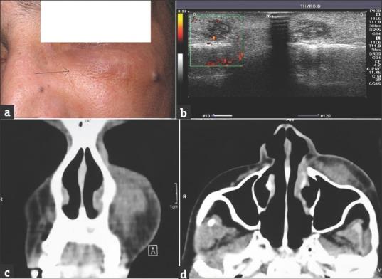 https://cdn.ncbi.nlm.nih.gov/pmc/blobs/e95c/4533559/e82b9e713983/IJD-60-420b-g001.jpg