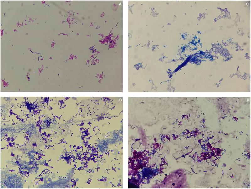 https://cdn.ncbi.nlm.nih.gov/pmc/blobs/e968/11090189/70bf5baaa0aa/IDR-17-1803-g0002.jpg