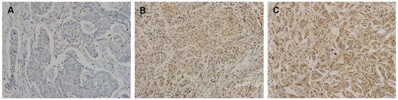 https://cdn.ncbi.nlm.nih.gov/pmc/blobs/e968/5667998/bda594cf1c2d/oncotarget-08-78781-g002.jpg