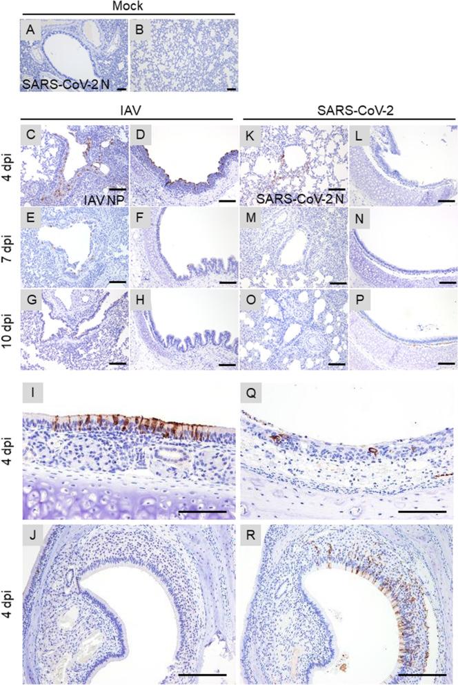 https://cdn.ncbi.nlm.nih.gov/pmc/blobs/e969/8553868/cc367913e809/41598_2021_809_Fig4_HTML.jpg