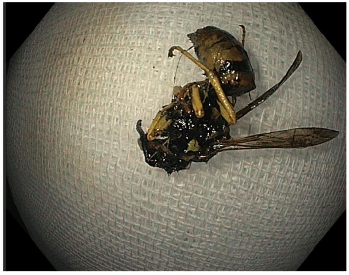 https://cdn.ncbi.nlm.nih.gov/pmc/blobs/e96a/12199919/d2bb0b4b2510/reports-08-00026-g003.jpg