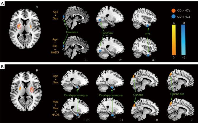 https://cdn.ncbi.nlm.nih.gov/pmc/blobs/e96c/11651968/0e32a2df99f7/qims-14-12-8320-f3.jpg