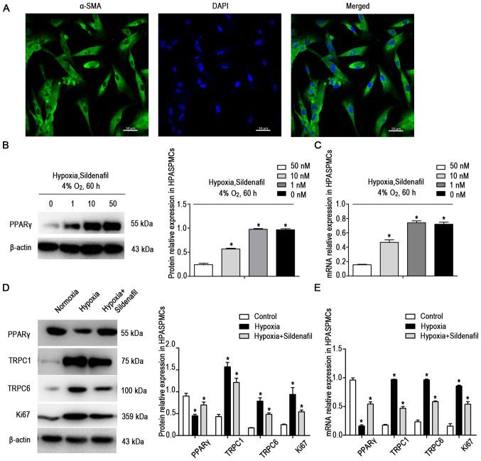 https://cdn.ncbi.nlm.nih.gov/pmc/blobs/e96c/8722768/14431e3d15cb/IJMM-49-02-05074-g04.jpg