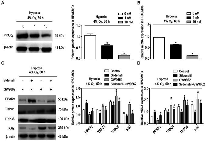https://cdn.ncbi.nlm.nih.gov/pmc/blobs/e96c/8722768/2b3b2c9f8fa4/IJMM-49-02-05074-g05.jpg