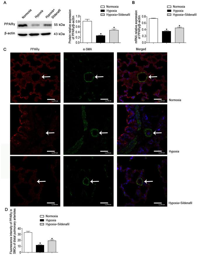 https://cdn.ncbi.nlm.nih.gov/pmc/blobs/e96c/8722768/71b2dedfee17/IJMM-49-02-05074-g01.jpg