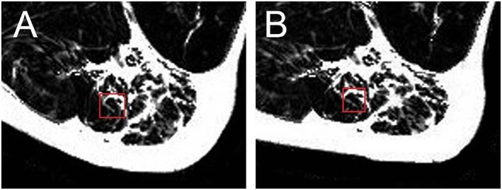 https://cdn.ncbi.nlm.nih.gov/pmc/blobs/e96d/6240750/2488fb6de315/JCSM-9-1093-g002.jpg