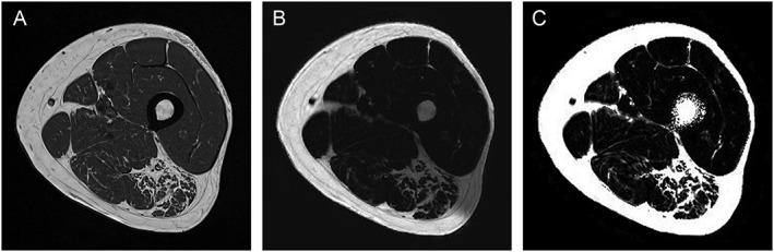 https://cdn.ncbi.nlm.nih.gov/pmc/blobs/e96d/6240750/db33de7fd1f4/JCSM-9-1093-g001.jpg