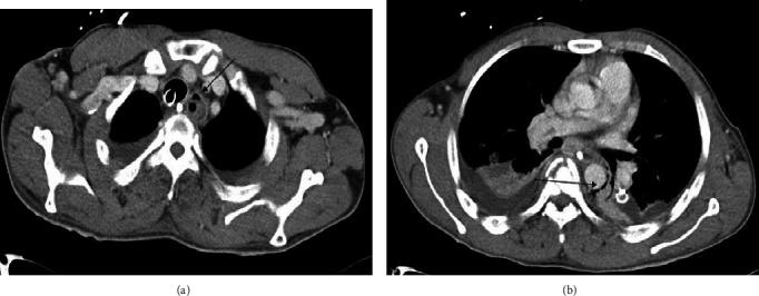 https://cdn.ncbi.nlm.nih.gov/pmc/blobs/e974/10076110/220bc9876f09/CRIS2023-4230158.003.jpg