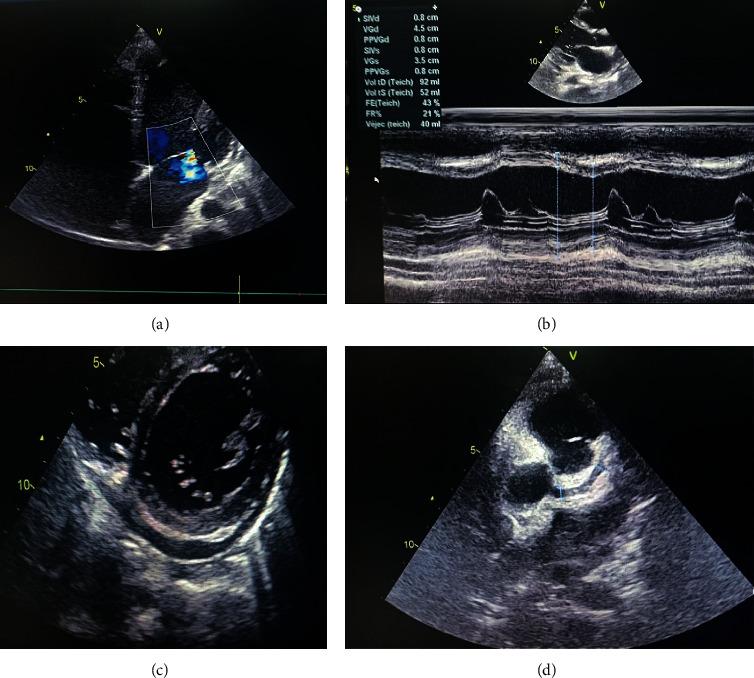 https://cdn.ncbi.nlm.nih.gov/pmc/blobs/e978/8337161/a64adc5b5d1e/CRIPE2021-8941847.004.jpg