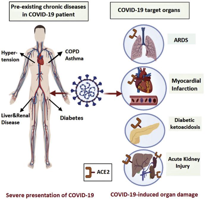 https://cdn.ncbi.nlm.nih.gov/pmc/blobs/e97f/7700729/f26059e03a61/gr1_lrg.jpg