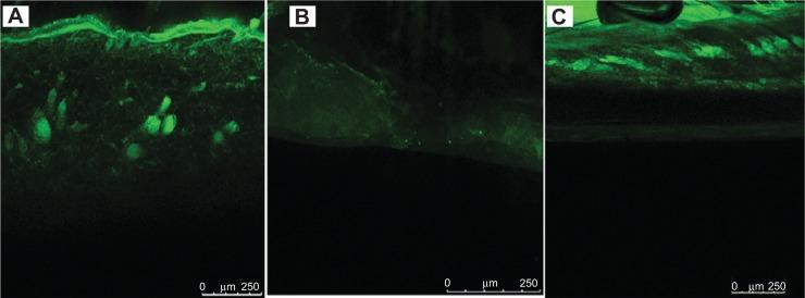 https://cdn.ncbi.nlm.nih.gov/pmc/blobs/e982/4168883/61363ab258f6/ijn-9-4331Fig7.jpg