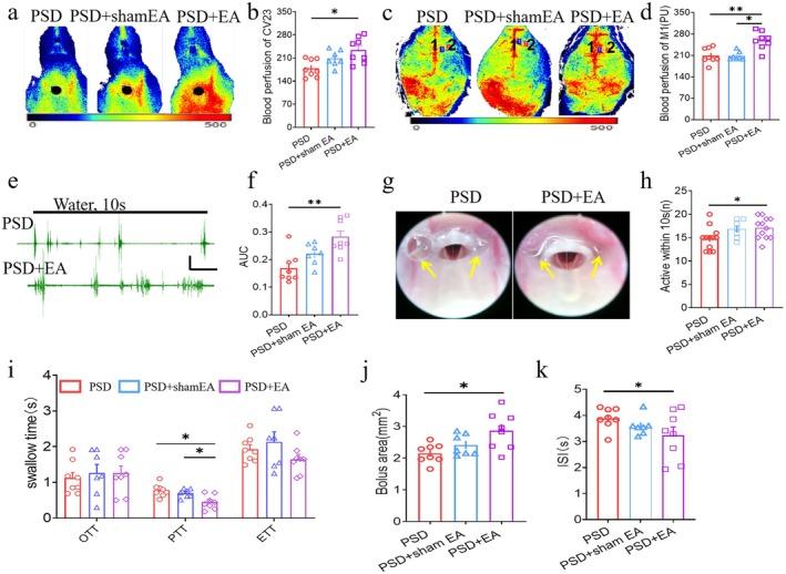 https://cdn.ncbi.nlm.nih.gov/pmc/blobs/e986/12289536/a1539dc21129/CNS-31-e70514-g004.jpg