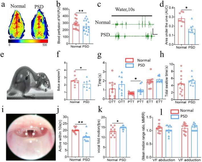 https://cdn.ncbi.nlm.nih.gov/pmc/blobs/e986/12289536/b5d088590fa2/CNS-31-e70514-g007.jpg