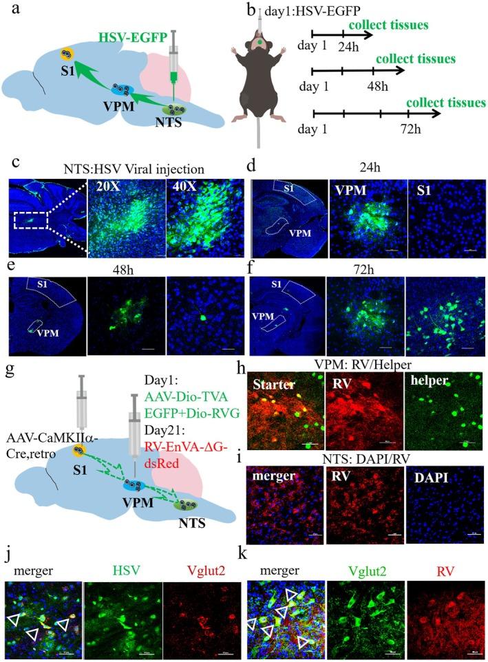 https://cdn.ncbi.nlm.nih.gov/pmc/blobs/e986/12289536/dfff302173cc/CNS-31-e70514-g008.jpg