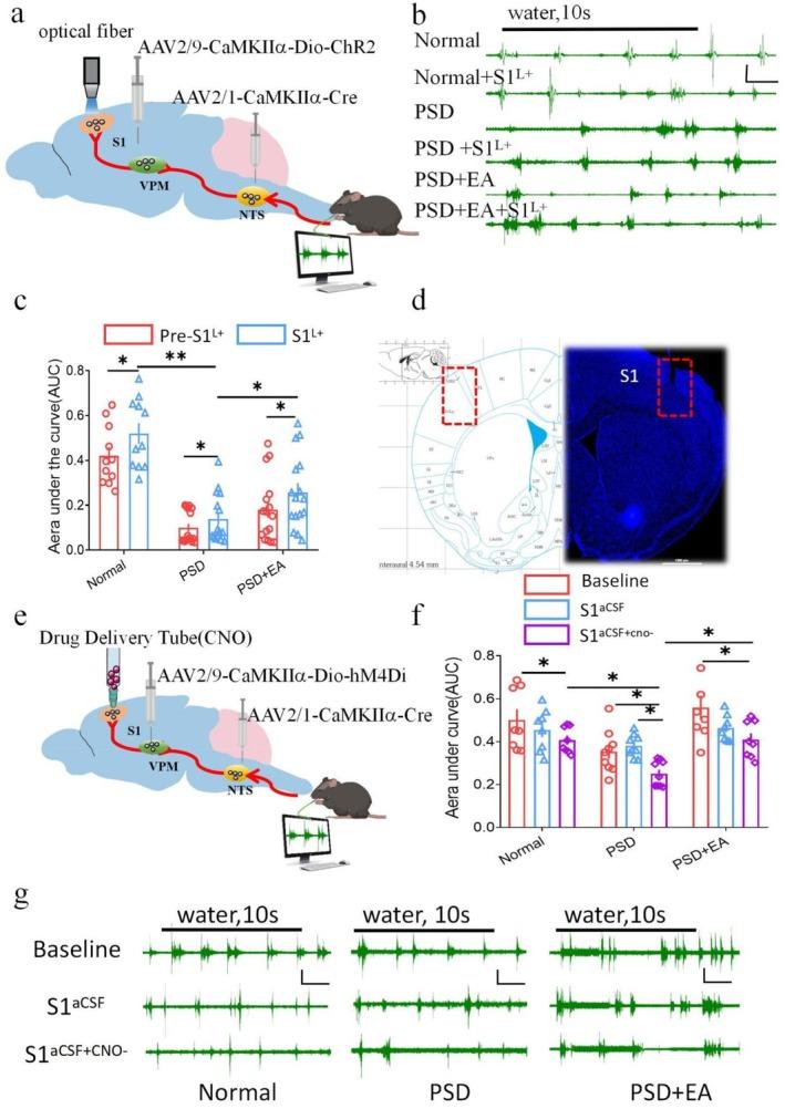 https://cdn.ncbi.nlm.nih.gov/pmc/blobs/e986/12289536/f876ef1ae724/CNS-31-e70514-g002.jpg