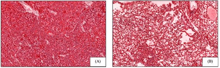 https://cdn.ncbi.nlm.nih.gov/pmc/blobs/e98a/11980527/5ce0f8251939/cureus-0017-00000080343-i02.jpg