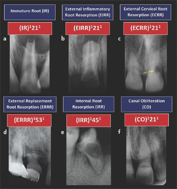 https://cdn.ncbi.nlm.nih.gov/pmc/blobs/e98f/8461493/8dc21741629d/EEJ-6-132-g010.jpg