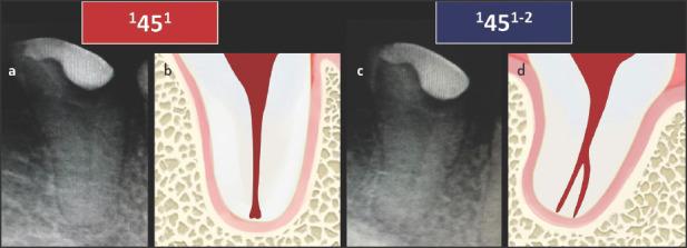 https://cdn.ncbi.nlm.nih.gov/pmc/blobs/e98f/8461493/c22ce52359a8/EEJ-6-132-g003.jpg