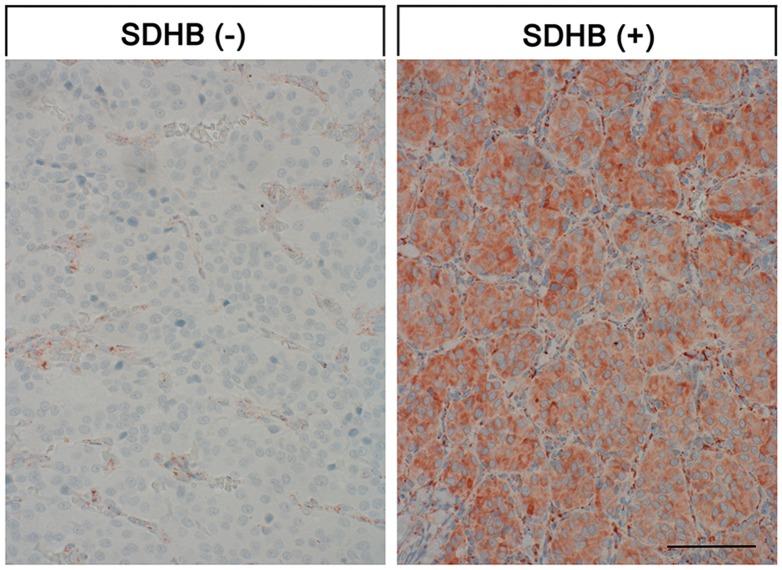 https://cdn.ncbi.nlm.nih.gov/pmc/blobs/e991/5685723/eba0575f1cb6/oncotarget-08-89958-g001.jpg