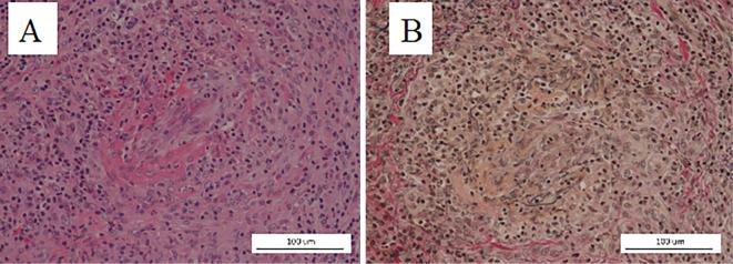 https://cdn.ncbi.nlm.nih.gov/pmc/blobs/e992/5140874/36f6c1644bda/1349-7235-55-3197-g002.jpg