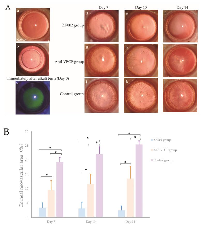 https://cdn.ncbi.nlm.nih.gov/pmc/blobs/e996/10805332/4663e03296c7/mv-v29-317-f1.jpg