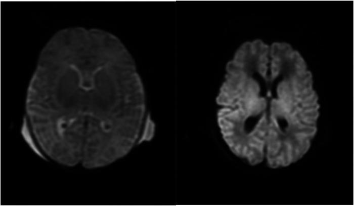 https://cdn.ncbi.nlm.nih.gov/pmc/blobs/e999/12313663/e339a9a0d1ba/fped-13-1571715-g001.jpg