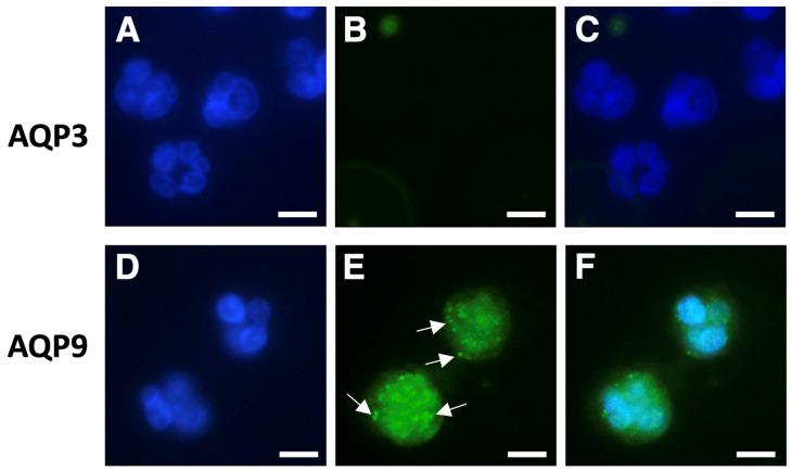 https://cdn.ncbi.nlm.nih.gov/pmc/blobs/e99e/12191162/1f53cafad8f9/cells-14-00880-g002.jpg