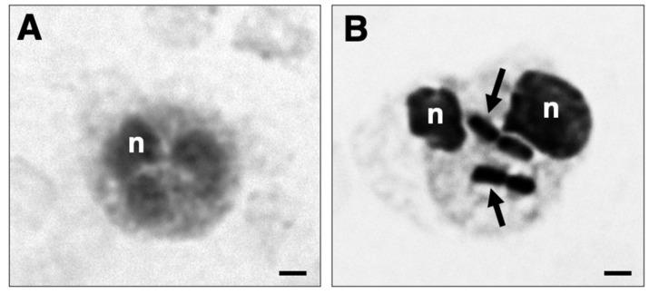 https://cdn.ncbi.nlm.nih.gov/pmc/blobs/e99e/12191162/4d7290cf6c18/cells-14-00880-g005.jpg