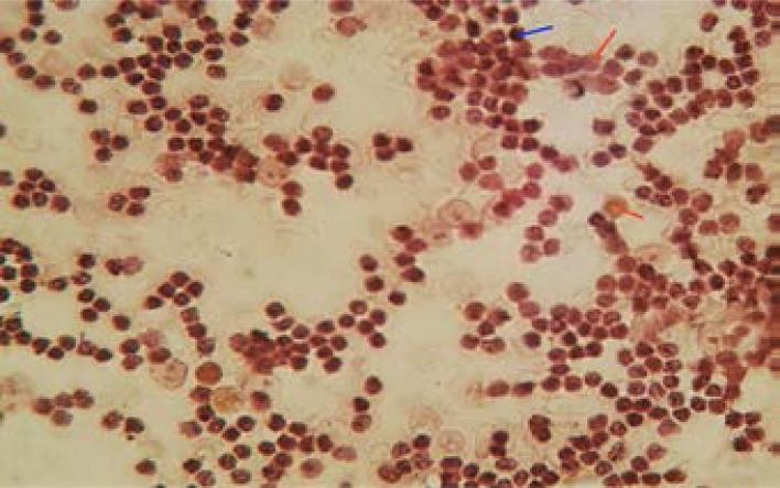 https://cdn.ncbi.nlm.nih.gov/pmc/blobs/e9a4/10782349/899bf7510638/AFHS2302-0265Fig1.jpg