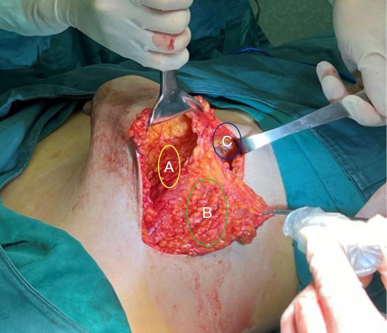 https://cdn.ncbi.nlm.nih.gov/pmc/blobs/e9bb/12177546/a1237bb18de3/gs-14-05-958-f1.jpg