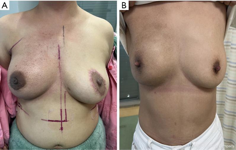 https://cdn.ncbi.nlm.nih.gov/pmc/blobs/e9bb/12177546/ff5741c5e90a/gs-14-05-958-f4.jpg
