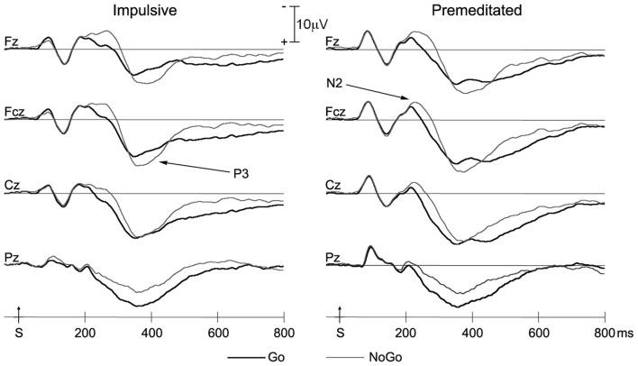https://cdn.ncbi.nlm.nih.gov/pmc/blobs/e9d6/5522866/8be33cef86d0/fnhum-11-00373-g0002.jpg