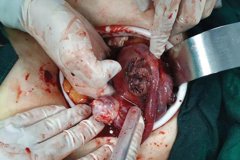 https://cdn.ncbi.nlm.nih.gov/pmc/blobs/e9d8/10238010/3265081dc163/medi-102-e33947-g002.jpg