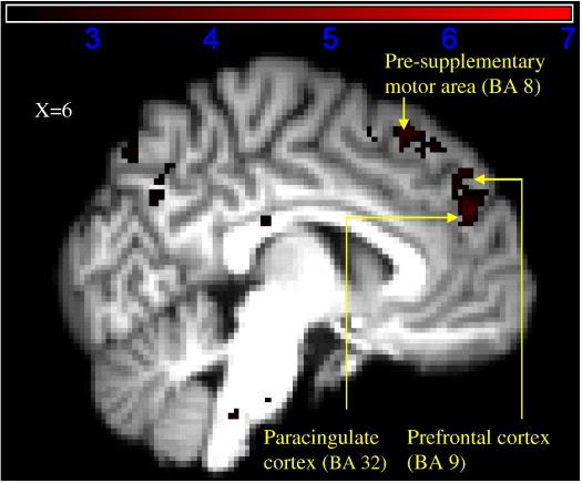 https://cdn.ncbi.nlm.nih.gov/pmc/blobs/e9da/2887490/afbac91d4664/gr3.jpg