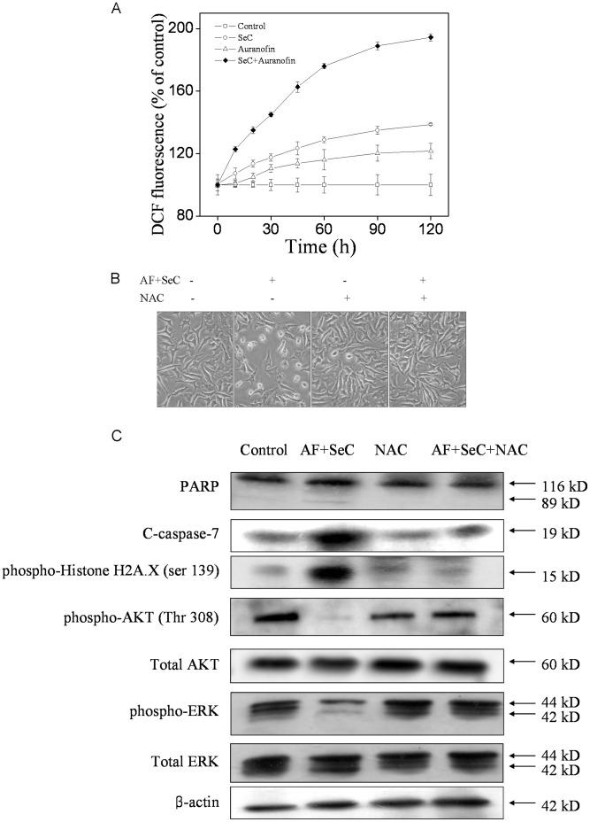 https://cdn.ncbi.nlm.nih.gov/pmc/blobs/e9de/3544722/fa544c58168a/pone.0053945.g007.jpg