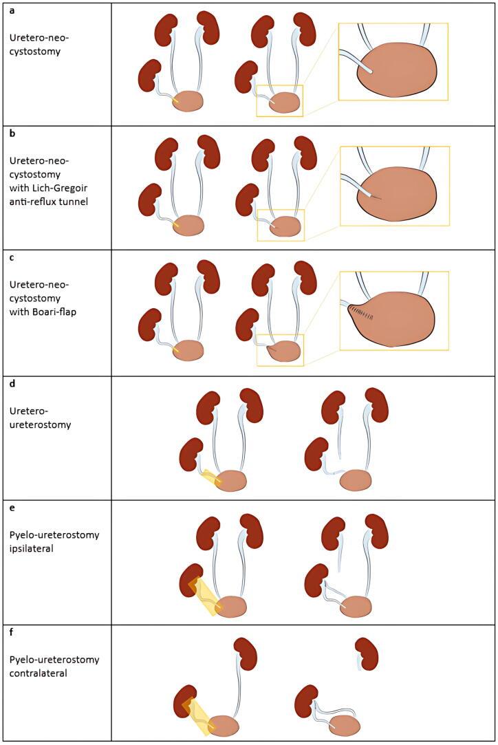 https://cdn.ncbi.nlm.nih.gov/pmc/blobs/e9e4/12169748/0c2a3397f6e9/gr1.jpg