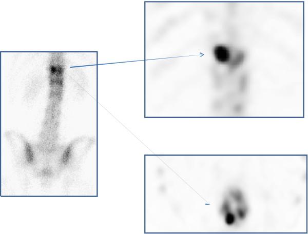 https://cdn.ncbi.nlm.nih.gov/pmc/blobs/e9e5/3308061/f2e04db7cd53/ar3375-6.jpg