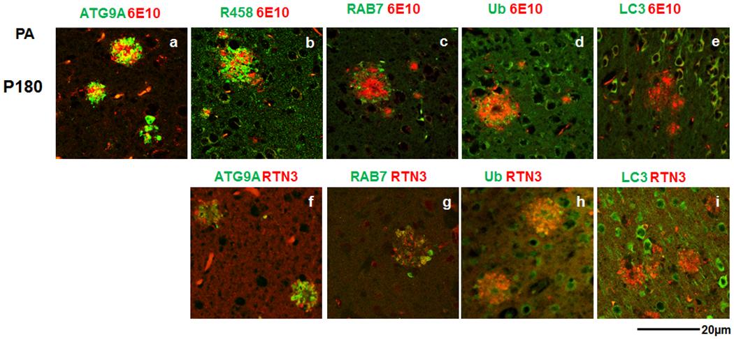 https://cdn.ncbi.nlm.nih.gov/pmc/blobs/e9e5/7204504/0b88918a4269/nihms-1521849-f0003.jpg