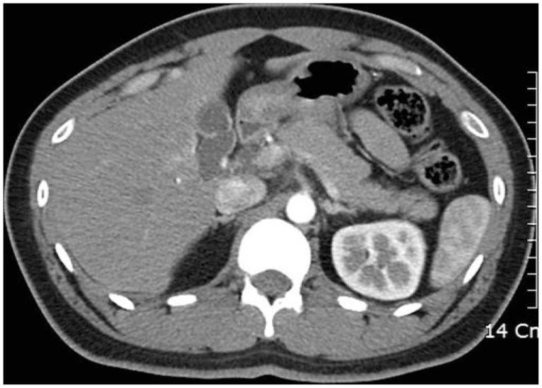 https://cdn.ncbi.nlm.nih.gov/pmc/blobs/e9eb/4260110/03bb2a781ca3/ce-47-579-g001.jpg